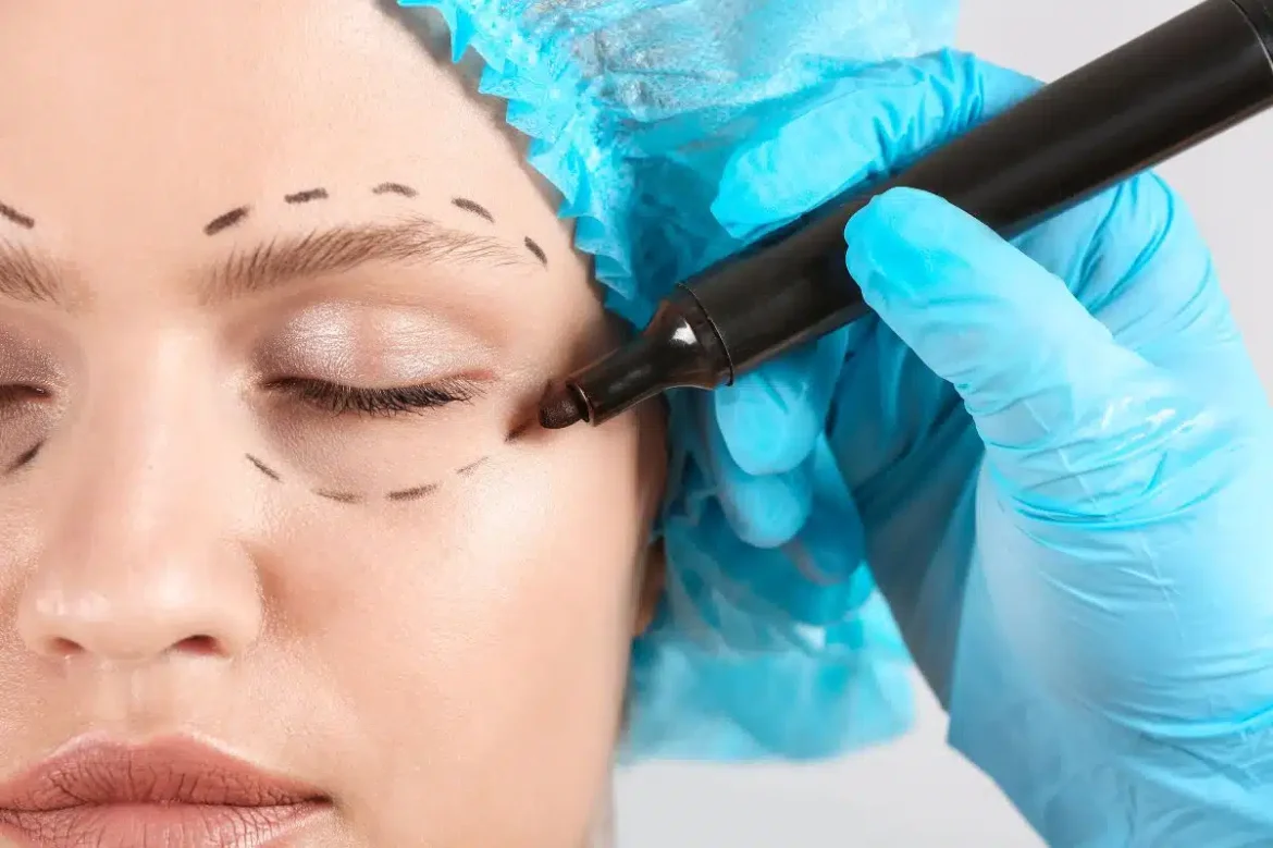 blepharoplasty under eye surgery